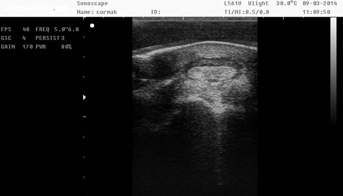 Orthopedic ultrasound